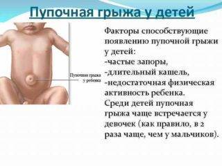 Комаровский - грыжа пупочная у новорожденных детей: лечение, массаж