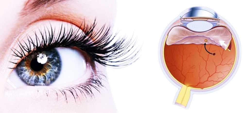 Что же это на самом деле: болезнь или нет? ангиопатия сетчатки обоих глаз