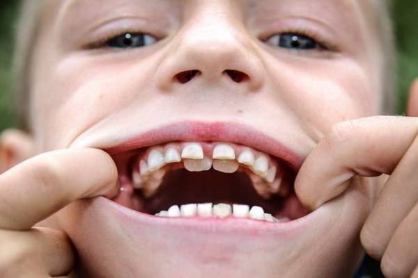 Коренные (постоянные) зубы — строение, виды и развитие, признаки появления у детей