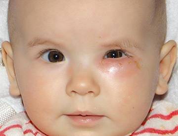 Цвет глаз - когда у новорожденных меняется цвет глаз - запись пользователя елена (eleviya) в сообществе здоровье новорожденных в категории разное - babyblog.ru