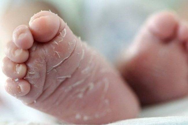 Шелушится кожа у новорожденного - стр. 2 - запись пользователя alexa (mermaidmarine) в сообществе здоровье новорожденных в категории кожные заболевания - babyblog.ru