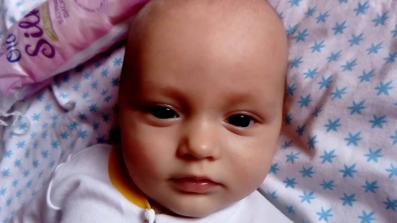 Правильный массаж при дакриоцистите - запись пользователя leno4ek (klenka118) в сообществе здоровье новорожденных в категории болезни глаз - babyblog.ru