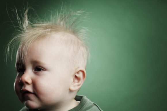 Выпадают волосы - выпадают волосы у грудничка 3 месяца - запись пользователя инна (mallory) в сообществе здоровье новорожденных в категории разное - babyblog.ru