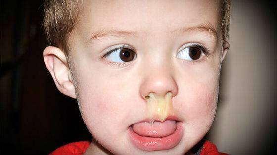 Жёлтые сопли у новорожденного. - запись пользователя анастасия (id1497063) в сообществе здоровье новорожденных в категории насморк и прочие заболевания носа - babyblog.ru