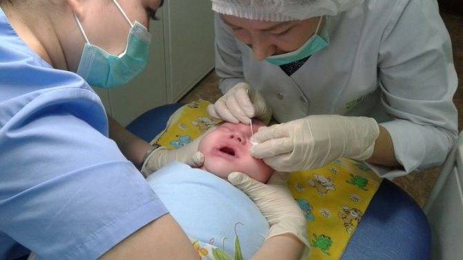 Зондирование слезного канала - запись пользователя юлия (id2642095) в сообществе здоровье новорожденных в категории болезни глаз - babyblog.ru