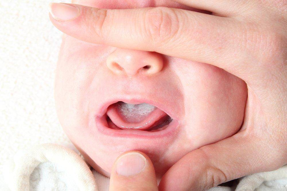 У ваших детей краснели щеки не на пищевой аллерген?