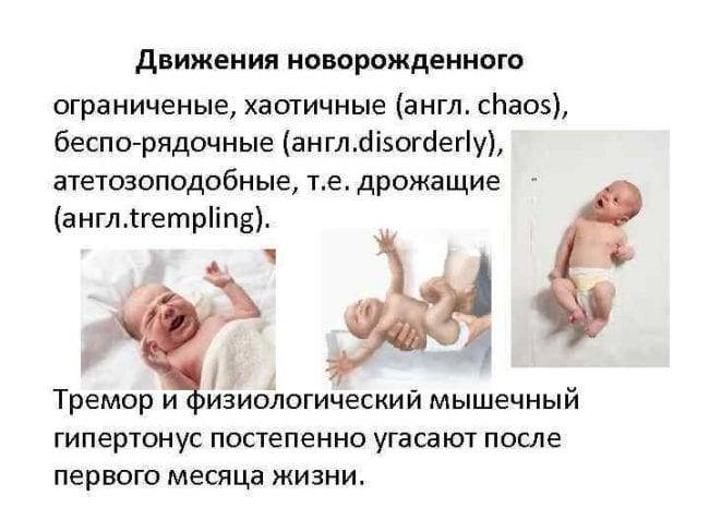 Тремор у новорожденных: причины и последствия тремора рук, ног, подбородка