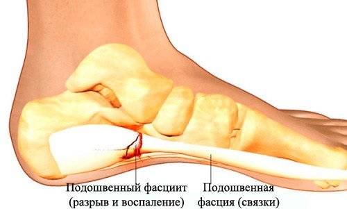 У ребенка болят ноги: после орви возникли осложнения на колени, мышцы, икры и суставы ног