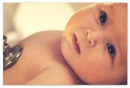 Chto-takoe-sklera-glaza - запись пользователя наталья (id775712) в сообществе здоровье новорожденных в категории желтуха новорожденных - babyblog.ru