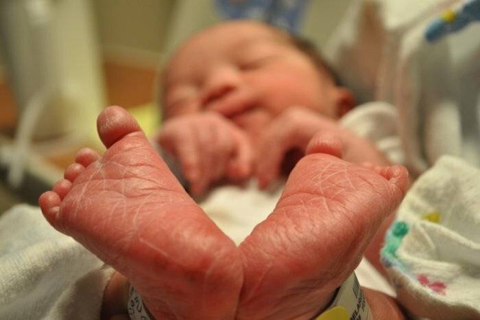 Гемолитическая болезнь новорожденных: как побороть и чего ждать в будущем