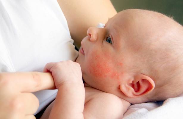 Здоровье новорожденного | как ухаживать за кожей