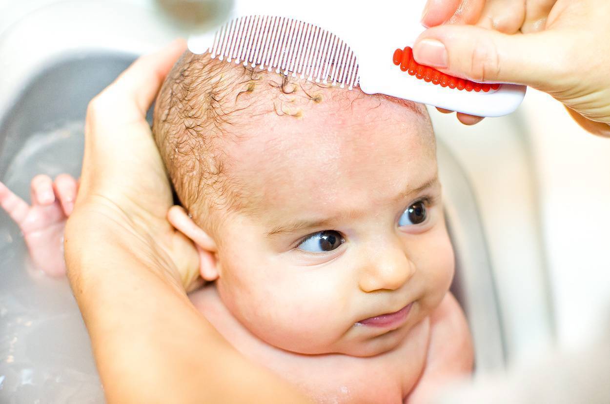 У новорожденного облазит кожа: почему слезает на теле, в паху, на руках и лице у грудничка