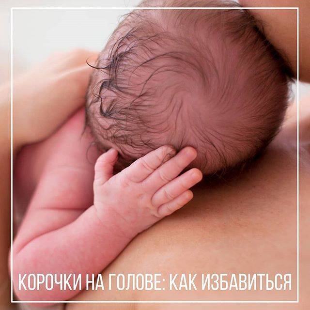 Shelushatsya-brovi - запись пользователя ольга (olgaliuh) в сообществе здоровье новорожденных в категории высыпания на коже - babyblog.ru