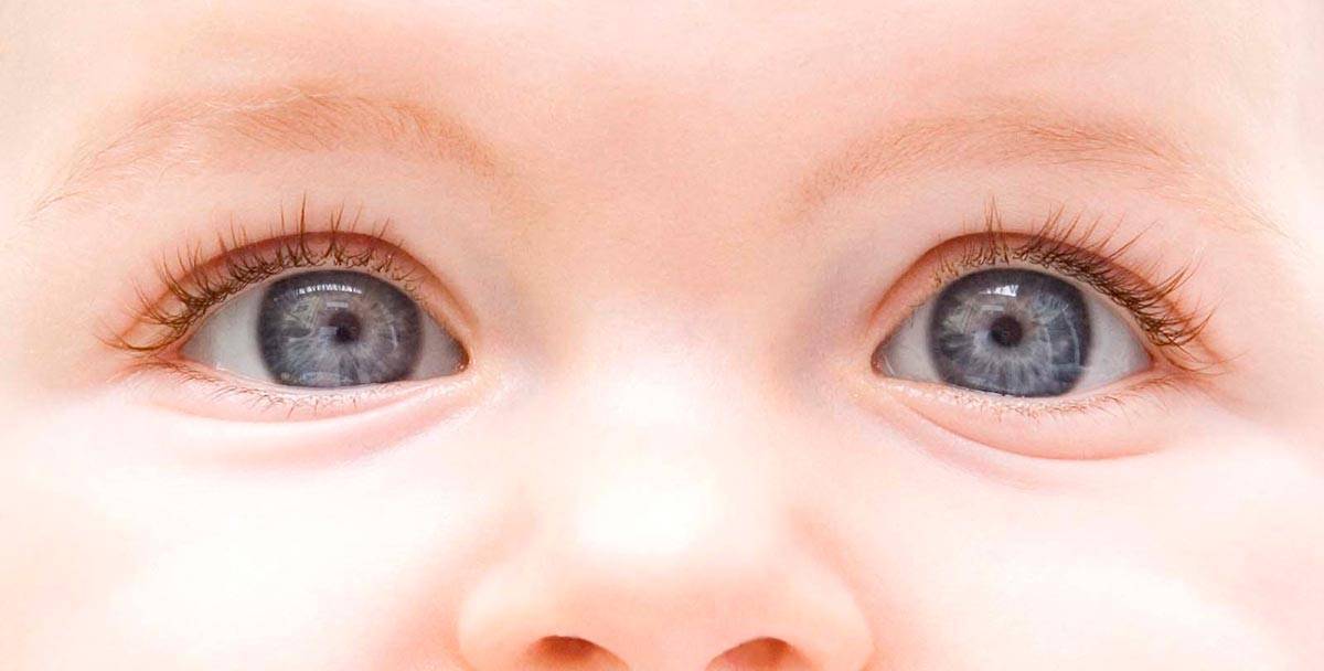 Гной в глазах у ребенка: причины, почему появляется и как лечить