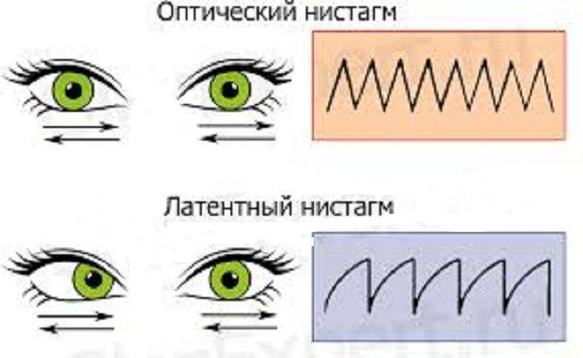 Закатывает глаза вниз( - запись пользователя margo xoroshilova (margoxoroshilova) в сообществе здоровье новорожденных в категории неврология - babyblog.ru