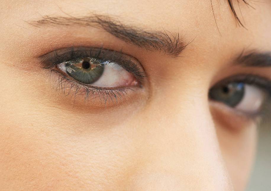 Причины возникновения темных кругов под глазами у мужчин. cиняки и темные круги под глазами у мужчин: как избавиться
