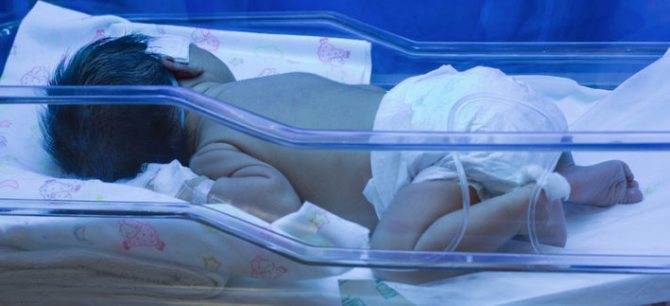 Желтуха новорожденных (для врачей и пациентов) (рмс) - начальная стадия желтухи у новорожденных - запись пользователя komareks (id1821139) в сообществе здоровье новорожденных в категории желтуха новорожденных - babyblog.ru