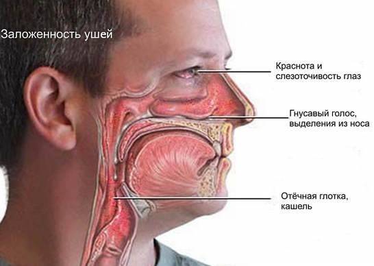 Комаровский: заложен нос, соплей нет у ребенка, чем лечить сильную заложенность носа