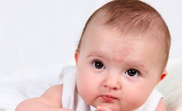 Жировики у новорожденного ребенка: почему появляются и как от них избавиться?