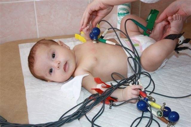 Kak-delaetsya-ekg - запись пользователя екатерина (katerinka_ea) в сообществе здоровье новорожденных в категории посещение врача - babyblog.ru