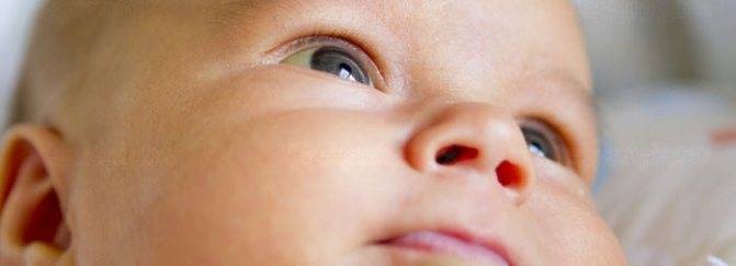 Е. комаровский: желтушка у новорожденных: когда должна пройти желтуха, лечение в домашних условиях
