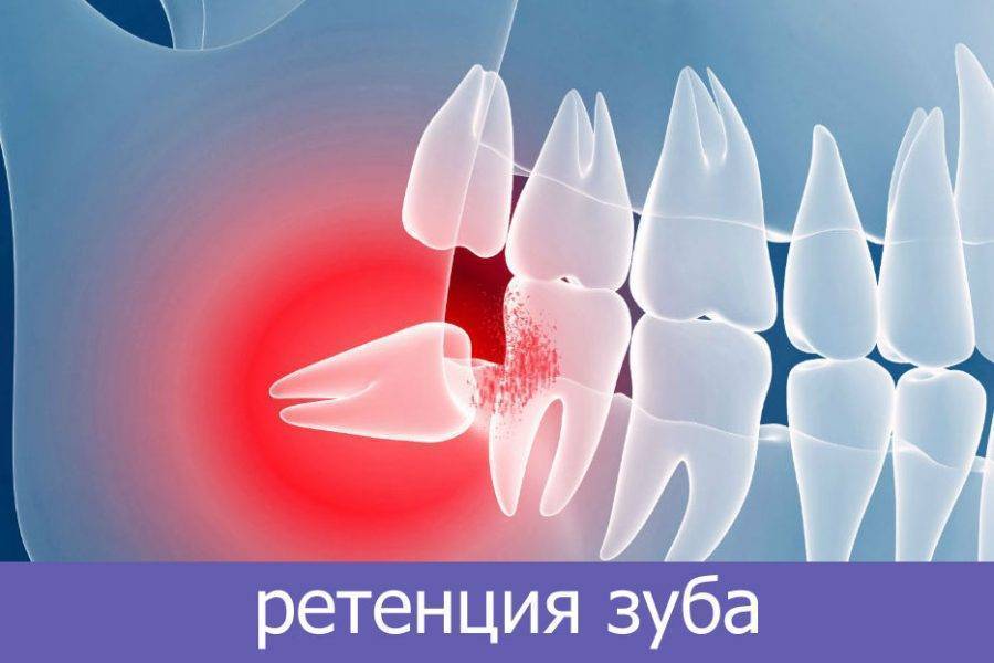 Зубы: признаки появления у грудничка
