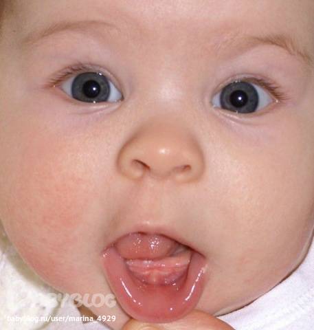 Зубы в 3 месяца??? - могут ли у трехмесячного ребенка резаться зубки - запись пользователя ева (evanova) в сообществе здоровье новорожденных в категории зубки и проблемы во время прорезывания - babyblog.ru