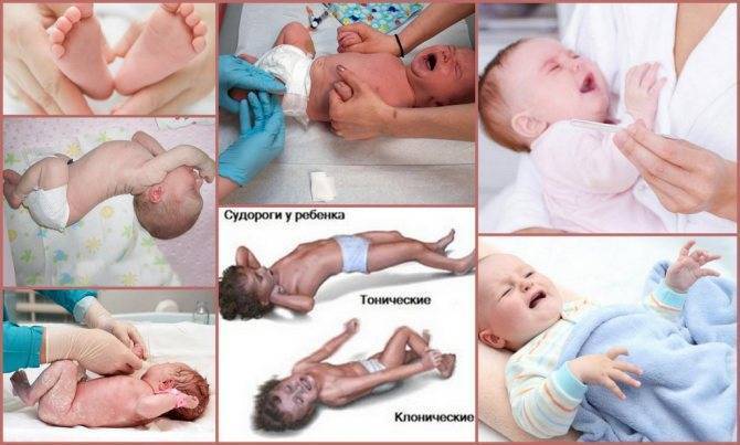 Симптомы судорог у новорожденных и грудничков, детей до года: как проявляются и как распознать, что делать