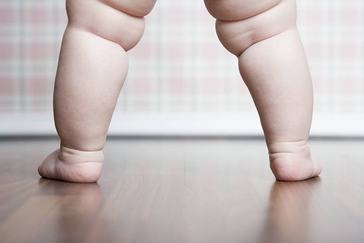 Ассиметрия складочек на ножках - может ли случиться что это норма? - ассиметричные складки на ножках у грудничка - запись пользователя юлия (b-jeal) в сообществе здоровье новорожденных в категории ортопедия - babyblog.ru