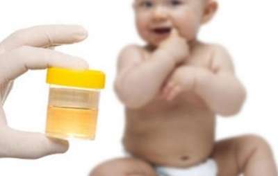 Соли в моче у ребенка: причины появления, диагностика и как лечить