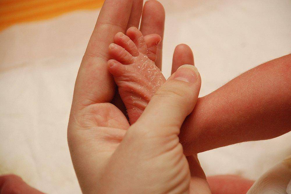 Почему облазит кожа на пальцах ног у ребенка?