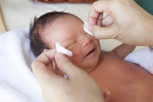 Мануальное лечение дакриоцистита, или как правильно делать массаж слезного канала у новорожденных