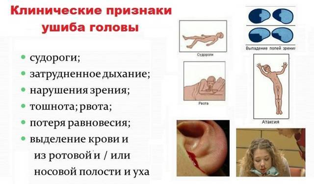 8 м, стоял у дивана, упал назад, ударился головой. - запись пользователя алена (zahardvic) в сообществе здоровье новорожденных в категории падение малыша - babyblog.ru