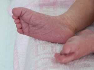 Почему облазит кожа на пальцах рук и ног у ребенка — возможные причины и лечение