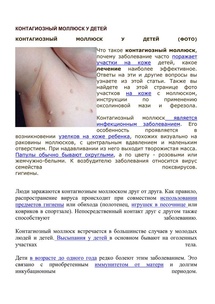 Контагиозный моллюск у ребенка: симптомы и лечение