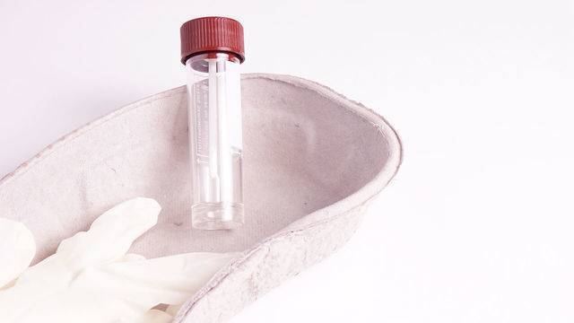 Анализы на гельминтов  – особенности сдачи и расшифровка результатов анализа кала на яйца глист, соскоба на энтеробиоз и анализ крови по ифа